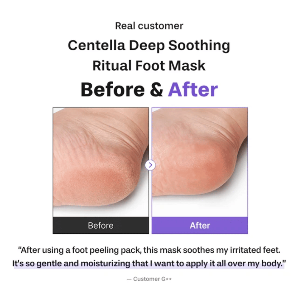6. Baren Centella Deep Soothing Ritual Foot Mask – zdjęcie przed i po pokazujące bardziej miękką i lepiej nawilżoną piętę po użyciu
