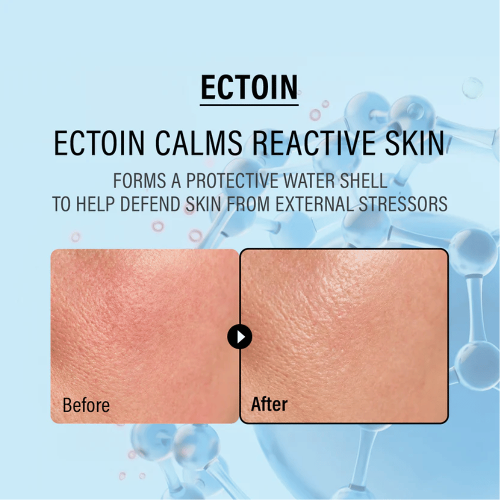 EPII Double Up Cream z ektoiną, która koi wrażliwą skórę, chroni przed czynnikami zewnętrznymi i wzmacnia naturalną barierę skóry.