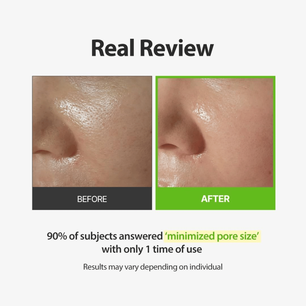 SUNGBOON EDITOR Green Tomato Pore Peeling Jumbo Pad – zdjęcie przed i po z naciskiem na widoczne pory