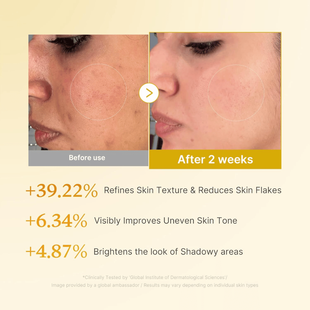 Zdjęcie przed i po dla Medicube Kojic Acid Turmeric Resurfacing Toner, pokazujące poprawioną teksturę skóry, bardziej wyrównany koloryt i zmniejszenie suchych łusek skóry po dwóch tygodniach stosowania.