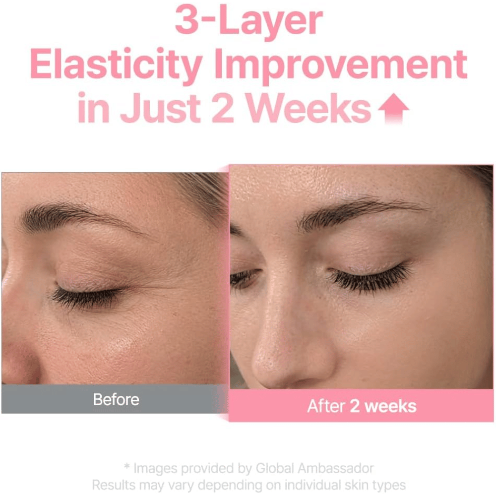 Zdjęcie przed i po dla Purito Multi PDRN Collagen EGF Serum, pokazujące poprawę elastyczności skóry po dwóch tygodniach.