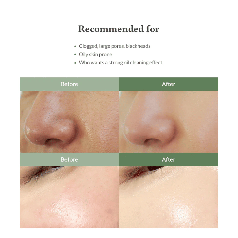 Dr. Althea Premium Quick Step Sebum Cleanser – oczyszczanie twarzy, które pomaga zmniejszyć zaskórniki, dogłębnie oczyścić pory i zapewnić gładszą strukturę skóry.