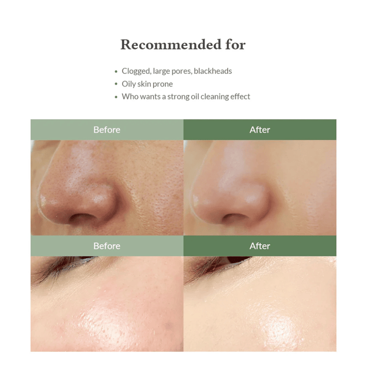 Dr. Althea Premium Quick Step Sebum Cleanser – oczyszczanie twarzy, które pomaga zmniejszyć zaskórniki, dogłębnie oczyścić pory i zapewnić gładszą strukturę skóry.